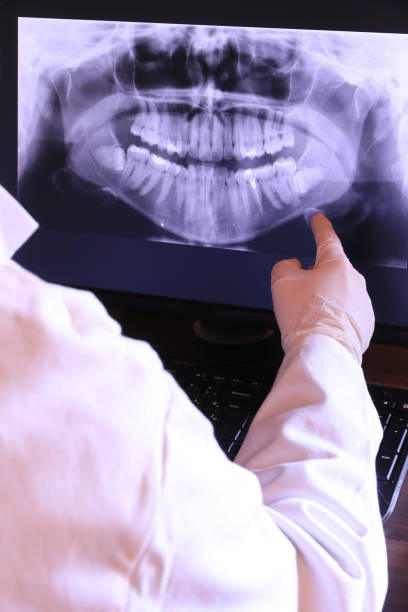Best Walk-In Emergency Dentist in St John, IN