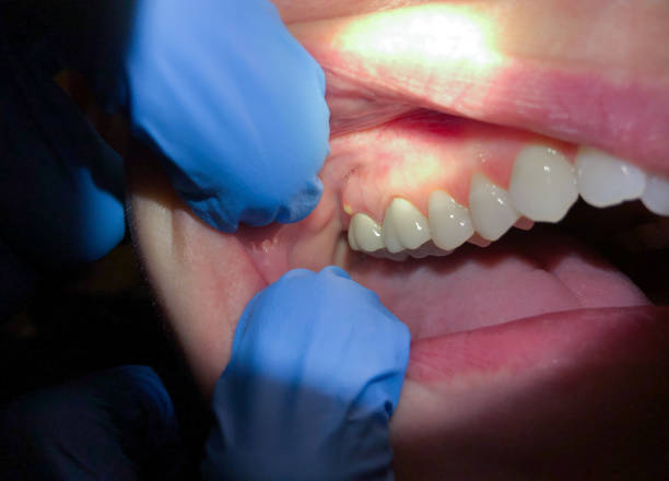 Best Pediatric Emergency Dentist in St John, IN