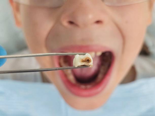 Best Weekend Emergency Dentist in St John, IN